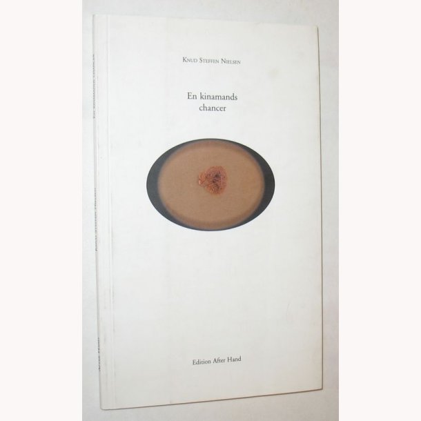 En kinamands chancer