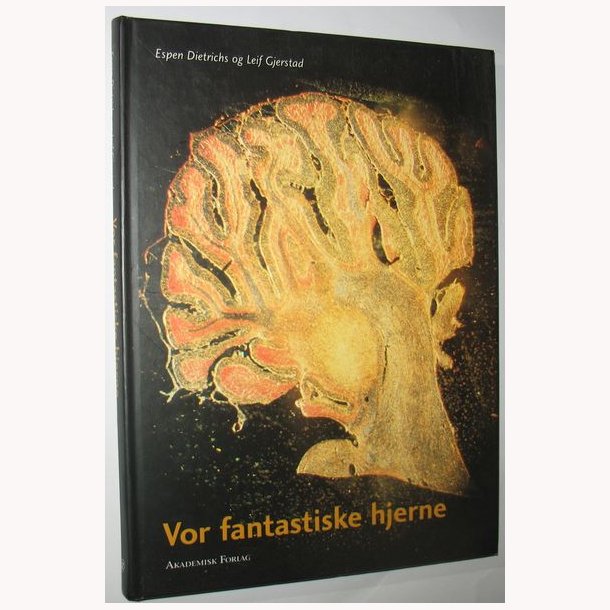 Vor fantastiske hjerne