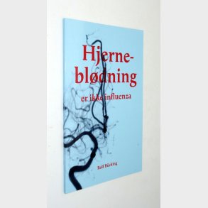 Hjernebldning er ikke influenza: Rolf Bcking