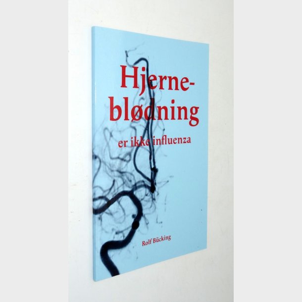 Hjernebldning er ikke influenza: Rolf Bcking