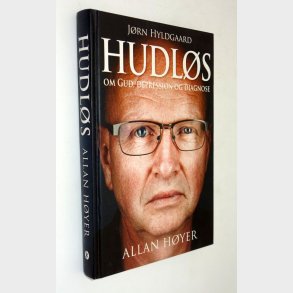 Hudl�s: Allan H�yer