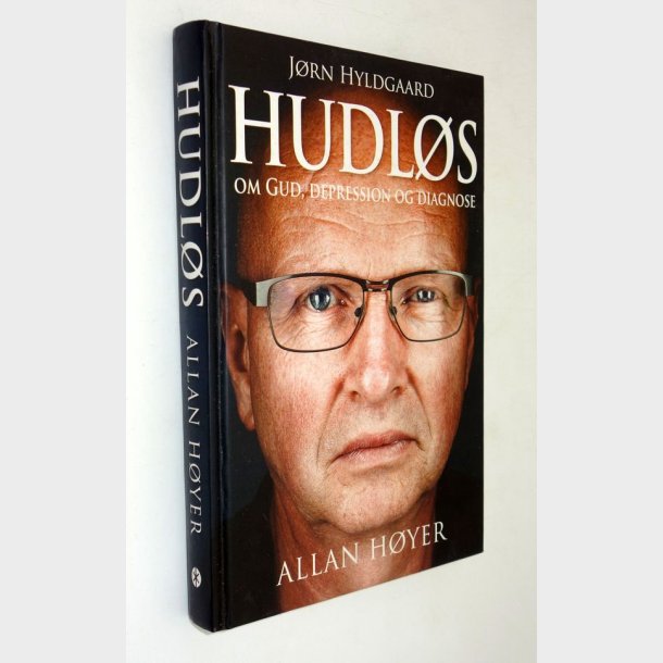 Hudl�s: Allan H�yer