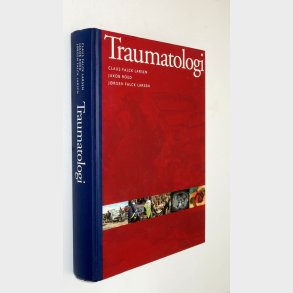 Traumatologi: Claus Falck Larsen